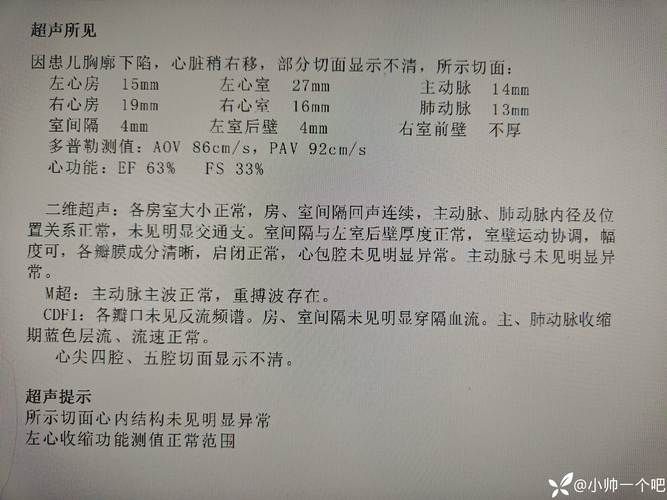 拱墅区最新疫情通报:寻找同轨迹人员_拱墅新型冠状病毒肺炎确诊病例