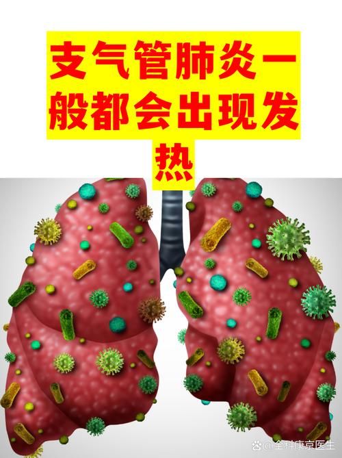 嘉善县近2天新增无症状感染者19例_嘉善疑似确诊新型肺炎