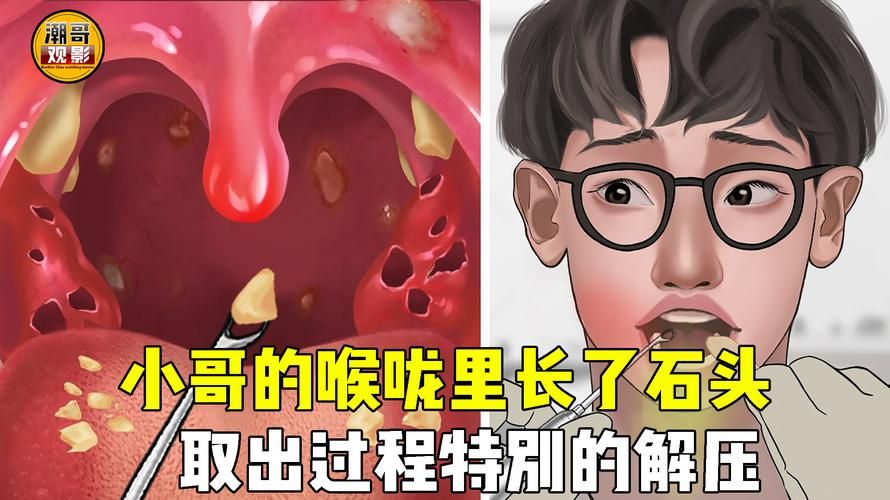 KS一秒5000赞是真的吗:科普一下