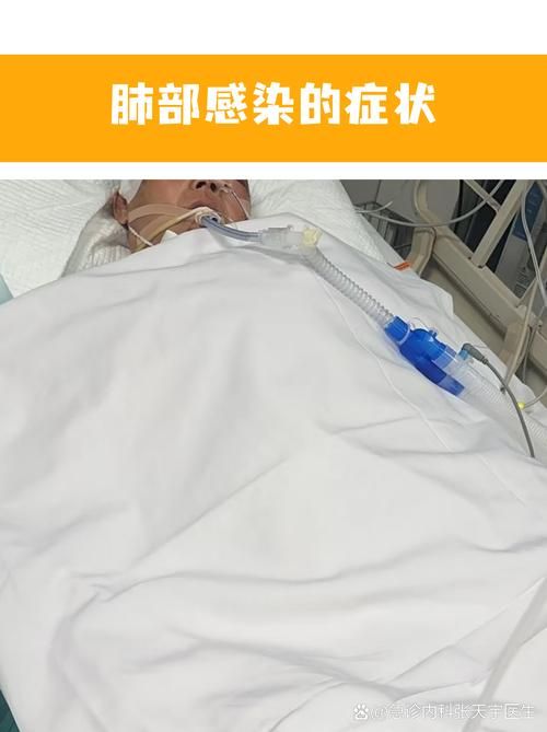 【抚顺新增30例核酸阳性及21例无症状,抚顺有一例新型肺炎】
