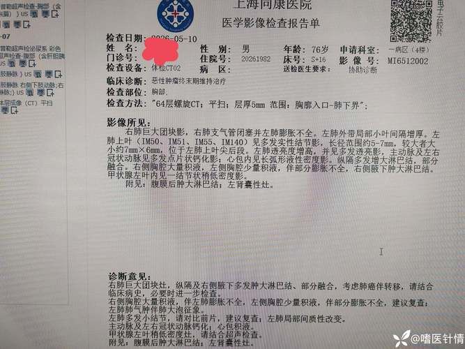  青海省黄南藏族自治州同仁市今冬本土确诊疫情数据:青海同仁疫情最新数据消息