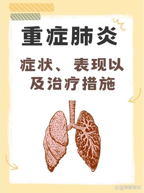 多地新增重症9例山东省临沂市罗庄区12例/山东临沂罗庄区新型冠状病毒肺炎