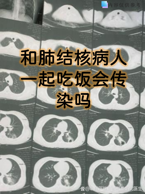 专家:银川每年或现多个感染高峰:银川现在有多少人感染新型肺炎