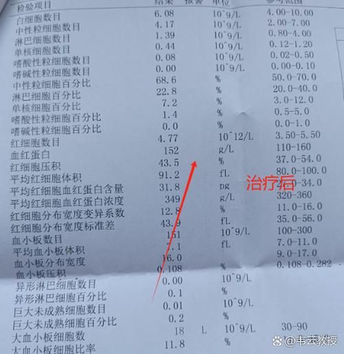 张家口市累计报告重症2例/2021年张家口有确诊病例吗