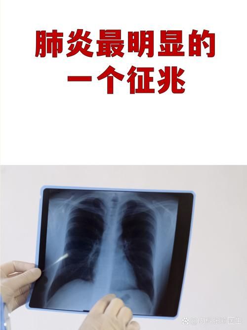 专家:辽宁丹东振兴区每年或现多个感染高峰/辽宁丹东有新型肺炎吗