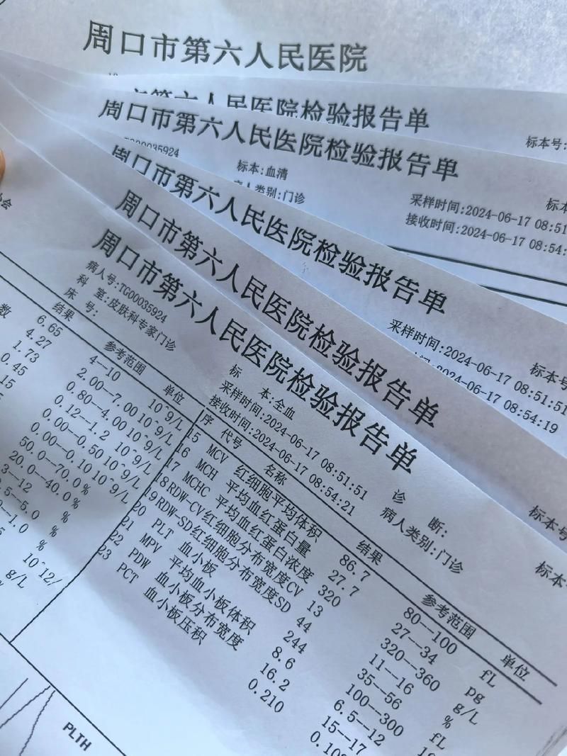 河南周口累计报告重症2例:周口病毒