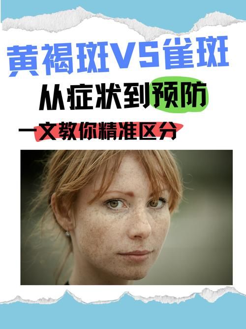 谯城区最新通告:所有人员解封/脸上长黄褐斑看什么科